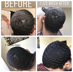 New Growth Me Stimulating Hair Oil - Natural Napes