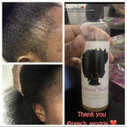 New Growth Me Stimulating Hair Oil - Natural Napes